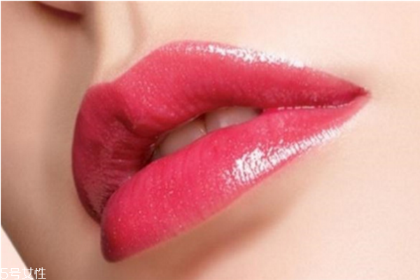 嘴角爛了能涂牙膏嗎 嘴角爛了的治療偏方 嘴角爛了能涂牙膏嗎 嘴角爛了的治療偏方