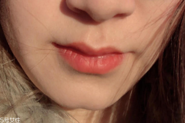 口紅病是什么樣的 發(fā)生幾率很小 口紅病是什么樣的 發(fā)生幾率很小