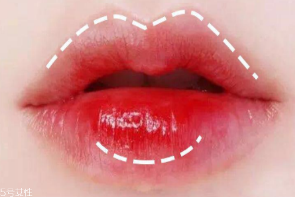 口紅病是什么樣的 發(fā)生幾率很小 口紅病是什么樣的 發(fā)生幾率很小