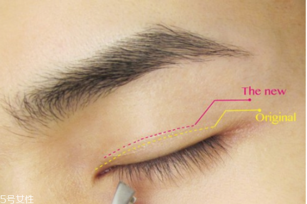 雙眼皮貼老是翻出來怎么辦 貼出自然持久雙眼皮 雙眼皮貼老是翻出來怎么辦 貼出自然持久雙眼皮