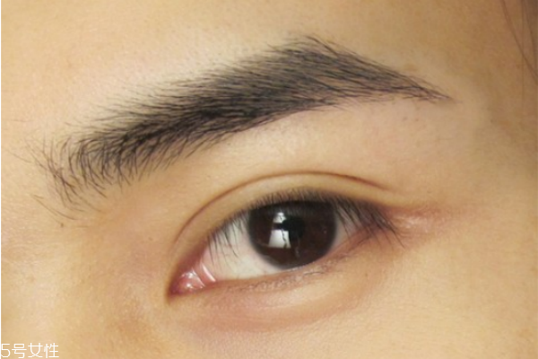 雙眼皮貼老是翻出來怎么辦 貼出自然持久雙眼皮 雙眼皮貼老是翻出來怎么辦 貼出自然持久雙眼皮