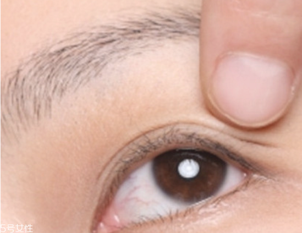 雙眼皮貼老是翻出來怎么辦 貼出自然持久雙眼皮 雙眼皮貼老是翻出來怎么辦 貼出自然持久雙眼皮