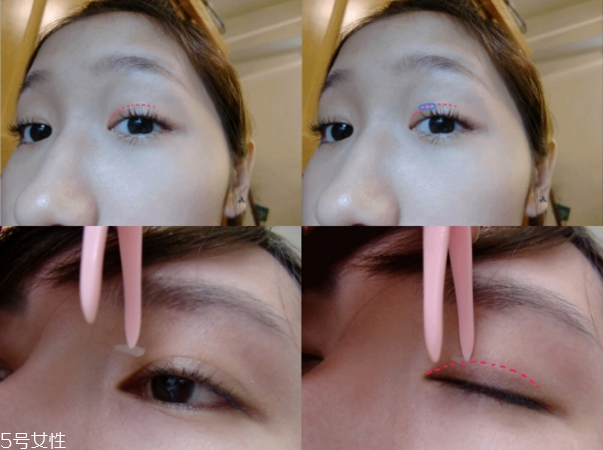 雙眼皮貼哪個牌子最好 告別無神雙眼 雙眼皮貼哪個牌子最好 告別無神雙眼