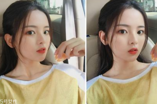 為什么嘴巴總是長痘痘 反復(fù)滋長4個原因