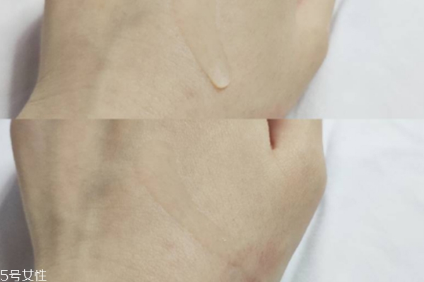 evm原液好用嗎 撫平痘痕就靠它 evm原液好用嗎 撫平痘痕就靠它