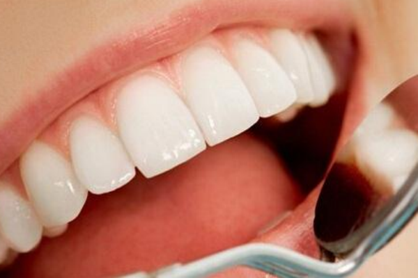 牙瓷貼片的效果怎么樣 牙瓷貼片的效果怎么樣