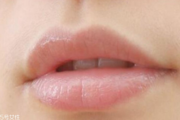 唇毛過重什么原因 2個(gè)因素自測(cè)一下