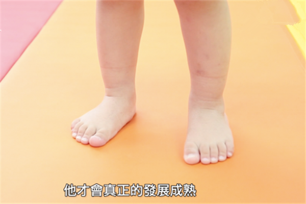 什么是扁平足 確診為扁平足要怎么恢復(fù) 什么是扁平足 確診為扁平足要怎么恢復(fù)