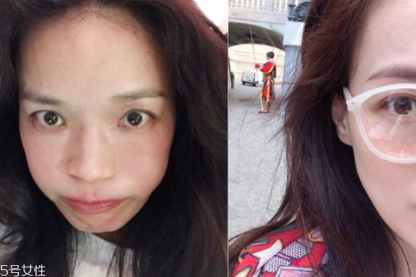 敏感肌怎樣保養(yǎng) 這4點(diǎn)請記好 敏感肌怎樣保養(yǎng) 這4點(diǎn)請記好