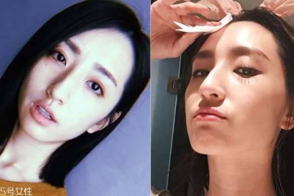 敏感肌怎樣保養(yǎng) 這4點(diǎn)請記好 敏感肌怎樣保養(yǎng) 這4點(diǎn)請記好