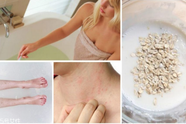 皮膚干癢起皮怎么辦 皮膚科醫(yī)生4大抗干癢秘技 皮膚干癢起皮怎么辦 皮膚科醫(yī)生4大抗干癢秘技