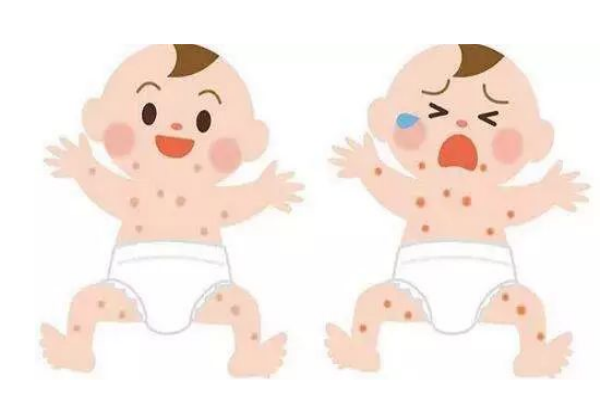 寶寶濕疹怎么辦 生活上要注意 寶寶濕疹怎么辦 生活上要注意