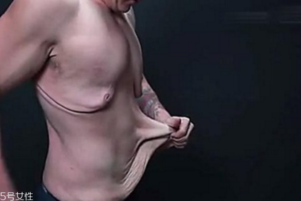 皮膚松弛，你應(yīng)該為肌膚補充營養(yǎng)