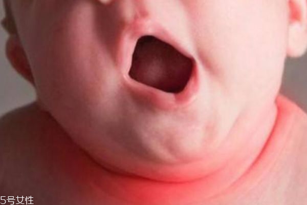 淹脖子是什么 怎么預防