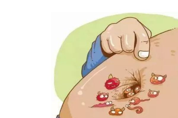 肚臍為什么不能用手摳 那該如何清洗肚臍 肚臍為什么不能用手摳 那該如何清洗肚臍