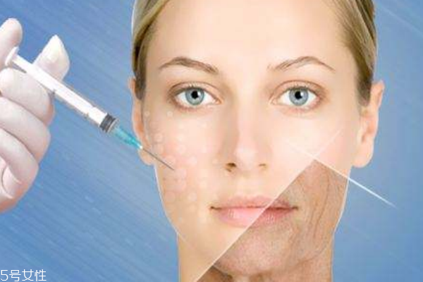 除皺的方法很多，你適合哪一種