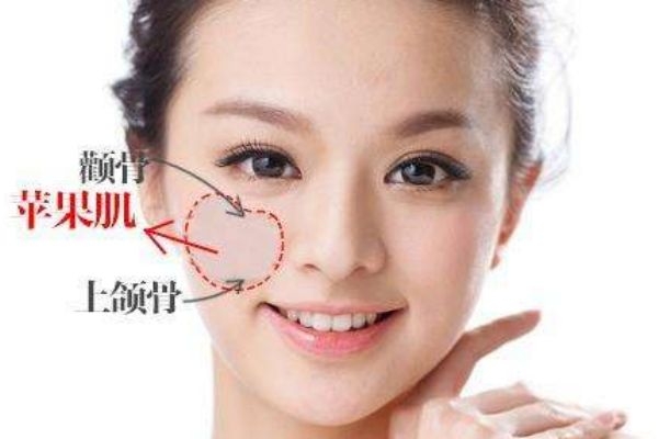 蘋果肌塌陷怎么辦 蘋果肌在哪個位置 蘋果肌塌陷怎么辦 蘋果肌在哪個位置