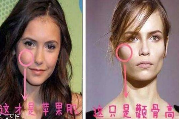 蘋果肌和顴骨高區(qū)別 別再傻傻分不清楚 蘋果肌和顴骨高區(qū)別 別再傻傻分不清楚