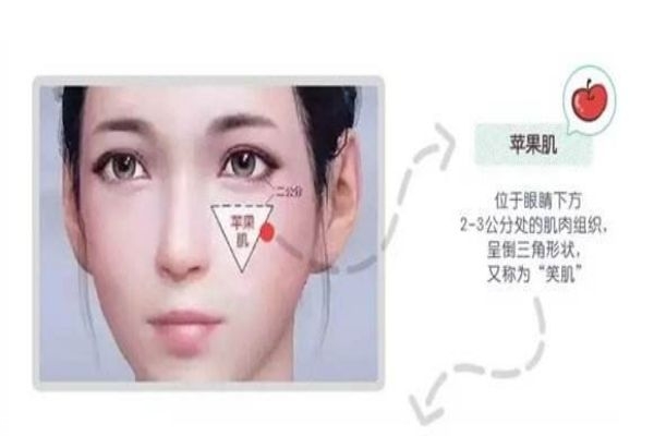 蘋果肌和顴骨高區(qū)別 別再傻傻分不清楚 蘋果肌和顴骨高區(qū)別 別再傻傻分不清楚