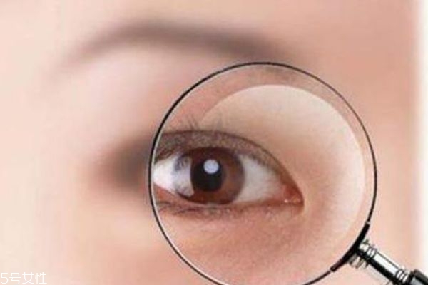 迎風(fēng)流眼淚是為什么 告別風(fēng)沙眼 迎風(fēng)流眼淚是為什么 告別風(fēng)沙眼