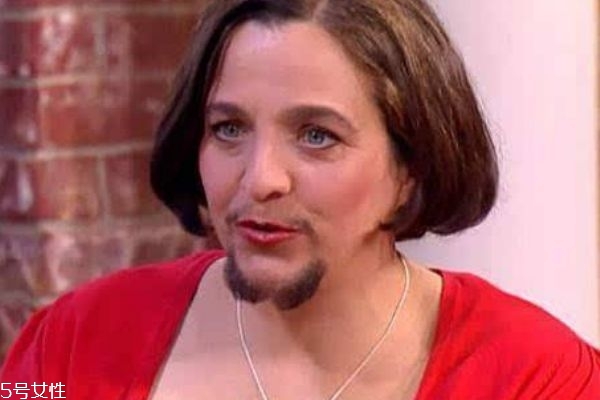 脫毛膏可以用在臉上嗎 脫唇毛小竅門 脫毛膏可以用在臉上嗎 脫唇毛小竅門