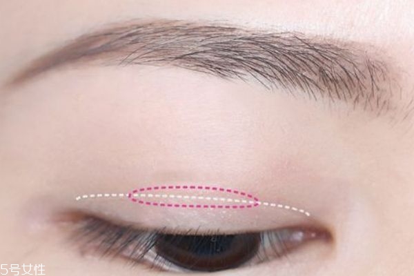 蕾絲雙眼皮貼適合的眼型 教你貼出最自然的雙眼皮 蕾絲雙眼皮貼適合的眼型 教你貼出最自然的雙眼皮