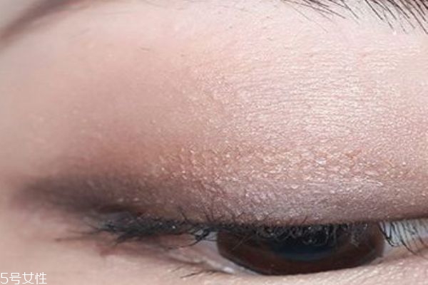 蕾絲雙眼皮貼適合的眼型 教你貼出最自然的雙眼皮 蕾絲雙眼皮貼適合的眼型 教你貼出最自然的雙眼皮