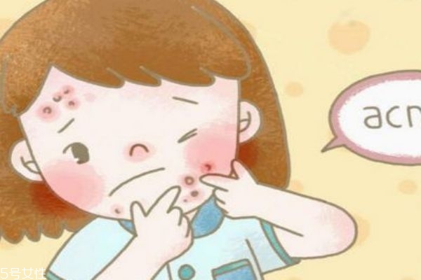 敷爾佳敷完要不要洗臉 敷爾佳面膜怎么樣 敷爾佳敷完要不要洗臉 敷爾佳面膜怎么樣