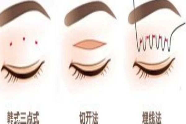 韓式三點(diǎn)和埋線(xiàn)的區(qū)別 你適合做什么樣的