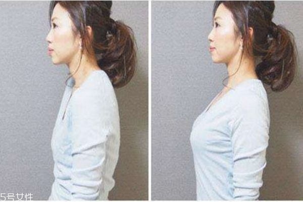 背背佳有副作用嗎 背背佳適用年齡 背背佳有副作用嗎 背背佳適用年齡