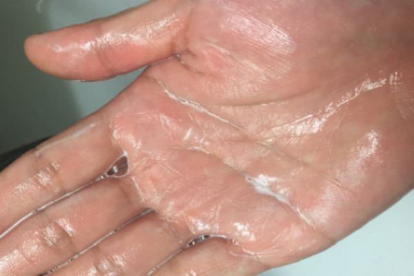 自然哲理洗面奶是氨基酸嗎 自然哲理洗面奶的功效 自然哲理洗面奶是氨基酸嗎 自然哲理洗面奶的功效