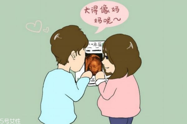 孕婦什么時候做四維彩超最好 孕婦什么時候做四維彩超最好