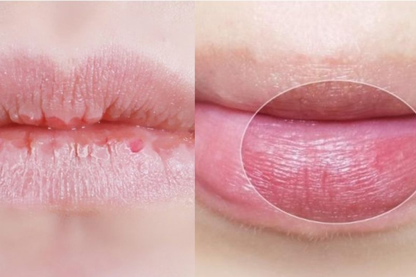 如何去除嘴部死皮 教你不傷嘴唇的方式 如何去除嘴部死皮 教你不傷嘴唇的方式