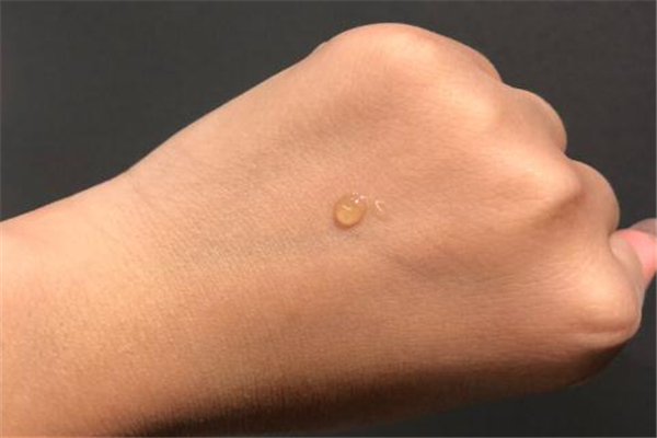 芙清凝膠多少錢(qián)一盒 皮膚修復(fù)首選 芙清凝膠多少錢(qián)一盒 皮膚修復(fù)首選