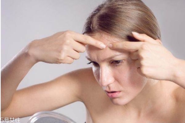 反復(fù)長痘痘怎么辦 反復(fù)長痘痘怎么調(diào)理 反復(fù)長痘痘怎么辦 反復(fù)長痘痘怎么調(diào)理