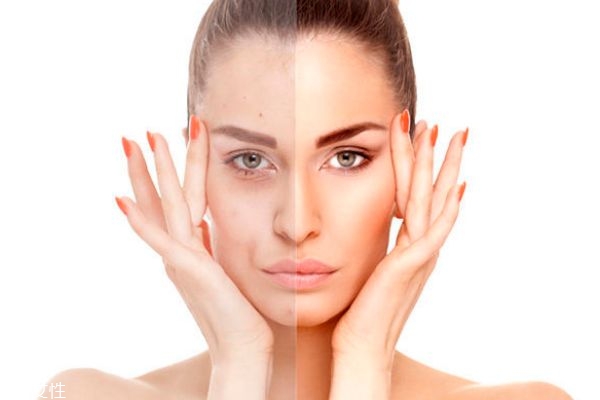 去死皮和洗面奶哪個先用 去死皮角質(zhì)的方法 去死皮和洗面奶哪個先用 去死皮角質(zhì)的方法