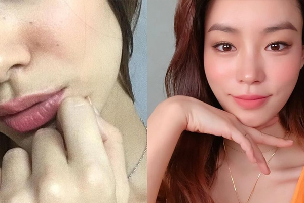 毛孔粗大什么原因引起的 搞懂4個毛孔類型 毛孔粗大什么原因引起的 搞懂4個毛孔類型