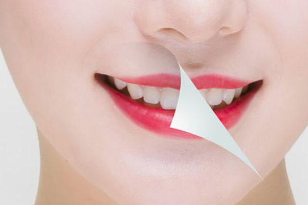 牙齒美白有哪些技術(shù) 4種技術(shù)怎么選擇 牙齒美白有哪些技術(shù) 4種技術(shù)怎么選擇