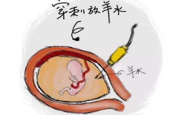 孕婦羊水過多對胎兒有害嗎 會危及胎兒性命 孕婦羊水過多對胎兒有害嗎 會危及胎兒性命