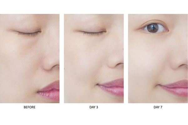 倩碧雙v安瓶精華真的有用嗎 倩碧雙v安瓶精華7天實(shí)測(cè) 倩碧雙v安瓶精華真的有用嗎 倩碧雙v安瓶精華7天實(shí)測(cè)