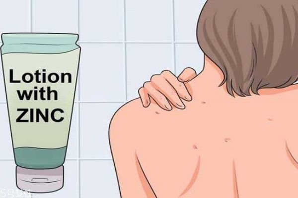 為什么背部會(huì)長痘痘 后背痘痘怎么快速去除 為什么背部會(huì)長痘痘 后背痘痘怎么快速去除