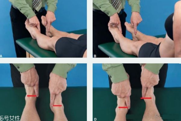 功能性長短腳怎么糾正 什么是長短腿 功能性長短腳怎么糾正 什么是長短腿