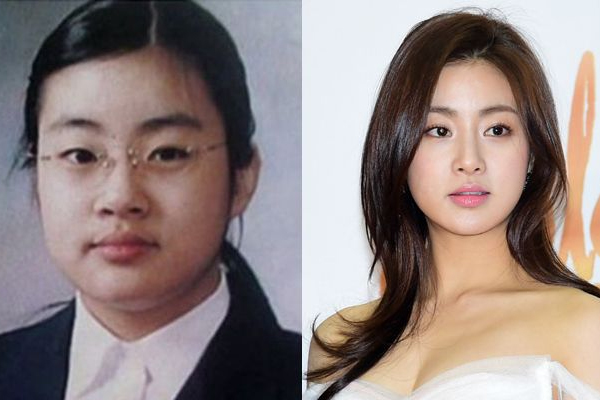 臉上水腫怎么消除最快 8種消水腫攻略 臉上水腫怎么消除最快 8種消水腫攻略