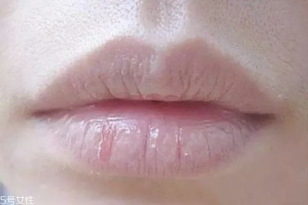 嘴唇為什么干燥 嘴唇干怎么保養(yǎng) 嘴唇為什么干燥 嘴唇干怎么保養(yǎng)