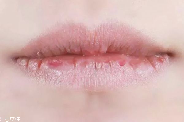 嘴唇為什么干燥 嘴唇干怎么保養(yǎng) 嘴唇為什么干燥 嘴唇干怎么保養(yǎng)