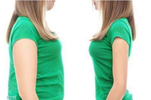 大腿上有肥胖紋怎么辦 教你如何有效去除肥胖紋 大腿上有肥胖紋怎么辦 教你如何有效去除肥胖紋