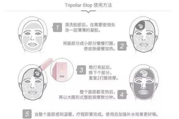 tripollar stop脖子能用嗎 tripollar stop使用時(shí)需注意