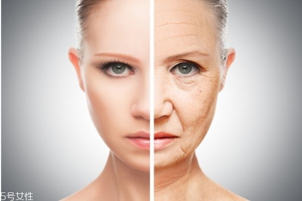 經(jīng)常熬夜長斑了怎么辦 熬夜長斑了能去掉嗎 經(jīng)常熬夜長斑了怎么辦 熬夜長斑了能去掉嗎