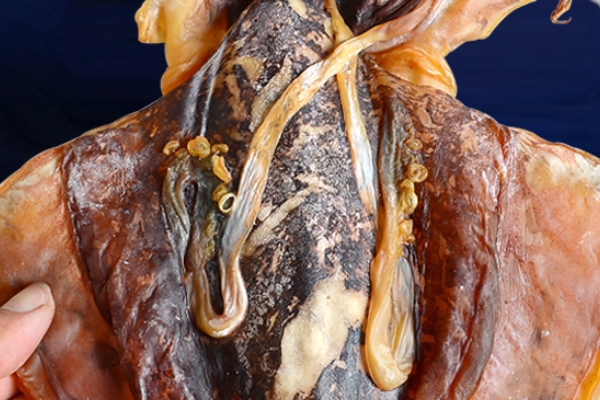 干墨魚(yú)煮熟要多久 半小時(shí)以上