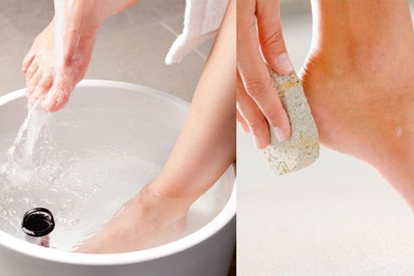 腳后跟干裂起硬皮怎么辦 3招拯救龜裂死皮 腳后跟干裂起硬皮怎么辦 3招拯救龜裂死皮